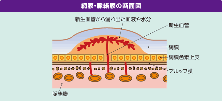 網膜・脈絡膜の断面図
