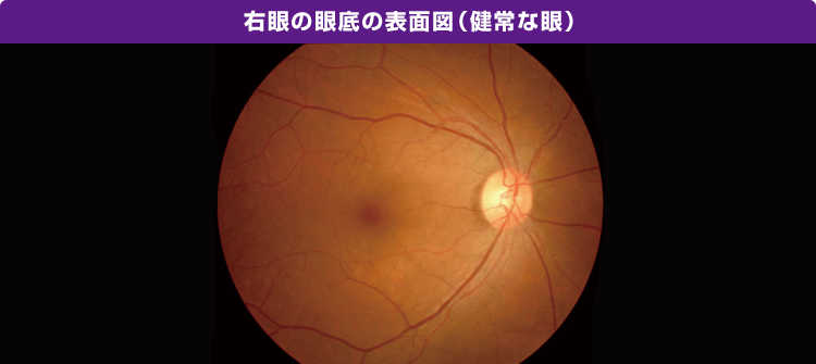 右眼の眼底の表面図(健常な眼)の画像