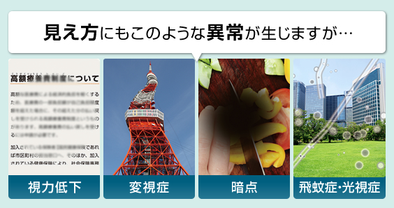 見え方にも「視力低下」「変視症」「暗点」「飛蚊症・光視症」のような異常が生じますが…