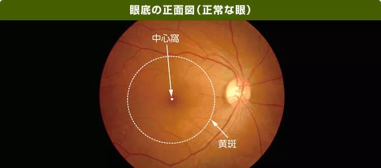 眼底の正面図（正常な眼）の画像