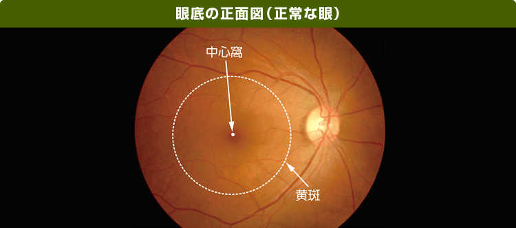 眼底の正面図(正常な眼)の画像