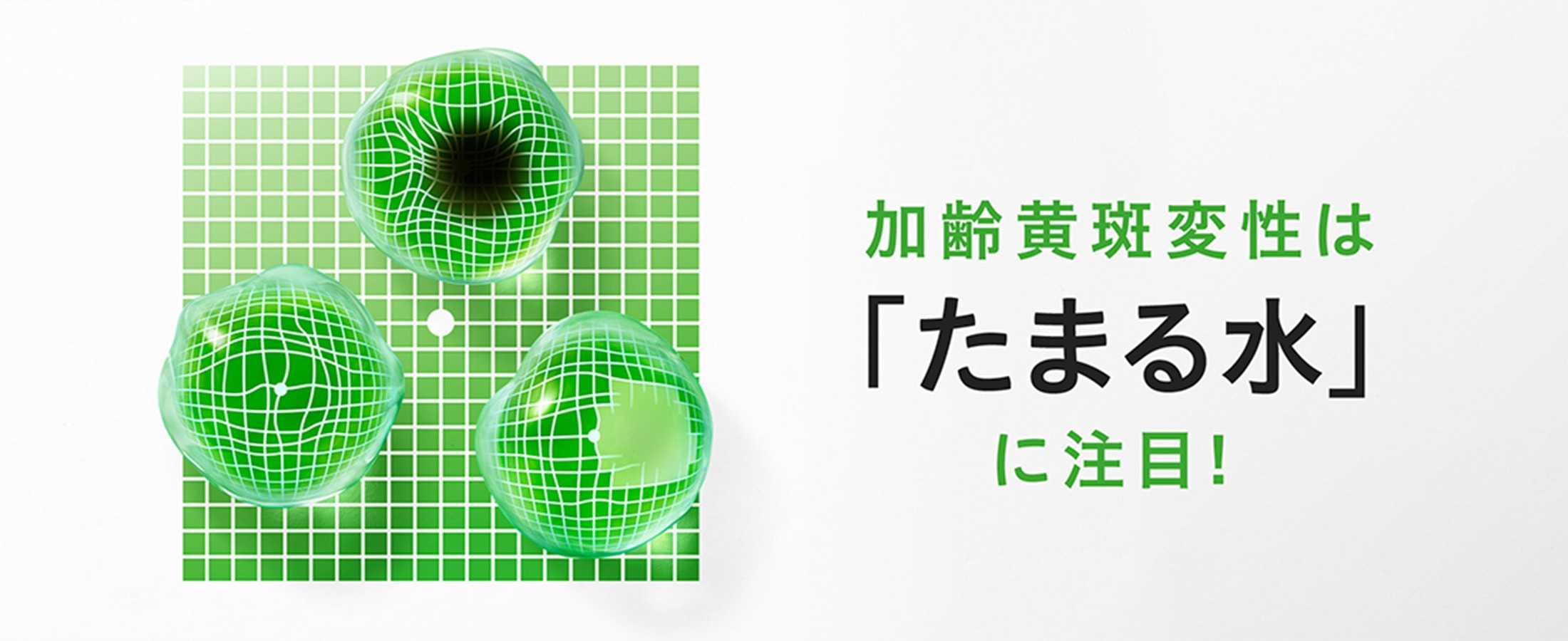 加齢黄班変性は「たまる水」に注目!