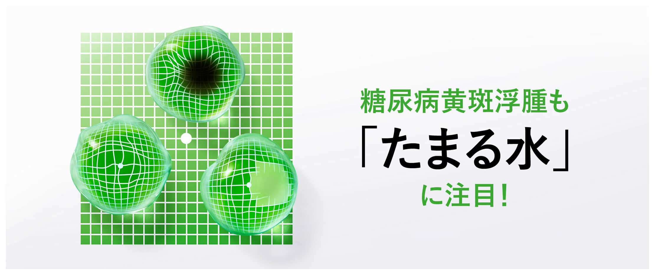 糖尿病黄斑浮腫も「たまる水」に注目!