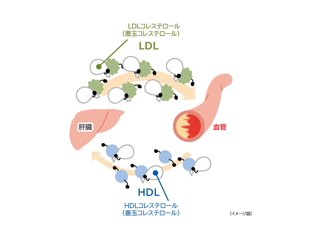 イメージ図：高コレステロール血症とはなんですか？