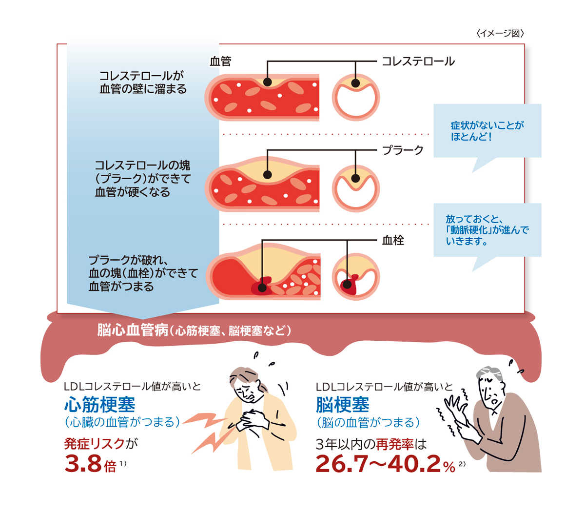 コレステロールが血管の壁に溜まる→コレステロールの塊(プラーク)ができて血管が硬くなる 症状がないことがほとんど！→プラークが破れ、血の塊(血栓)ができて血管がつまる 放っておくと、「動脈硬化」が進んでいきます。→　脳心血管病(心筋梗塞、脳梗塞など)　LDLコレステロール値が高いと心筋梗塞(心臓の血管がつまる)発症リスクが3.8倍 2)　LDLコレステロール値が高いと腦梗塞(脳の血管がつまる)3年以内の再発率は26.7～40.2% 3)