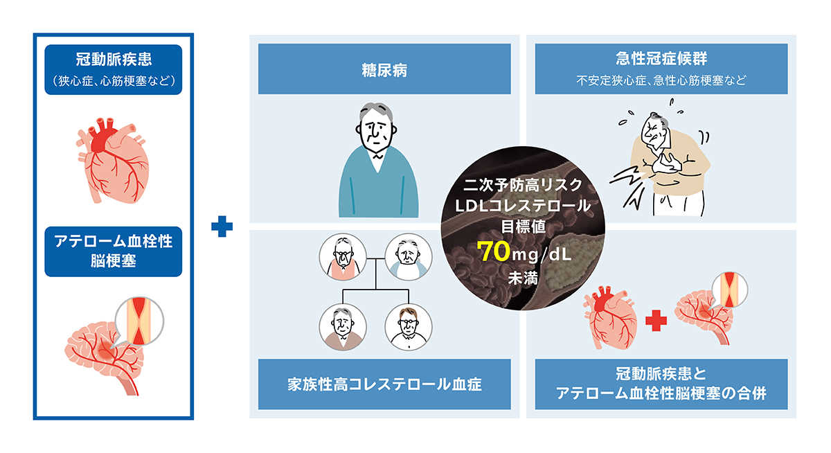 二次予防高リスク患者におけるLDLコレステロール管理目標値