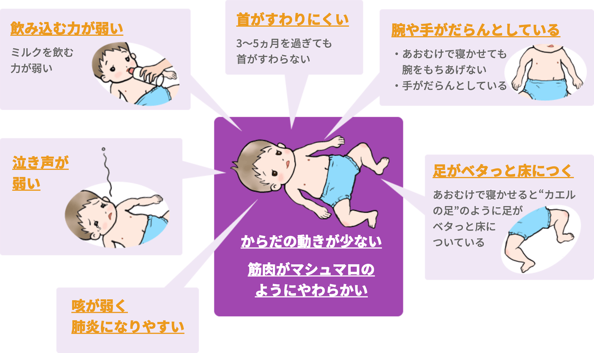 筋緊張低下がみられるお子さんでは、飲み込む力が弱い、首がすわりにくい、腕や手がだらんとしている、泣き声が弱い、足がベタっと床につく、咳が弱く肺炎になりやすい、からだの動きが少ない、筋肉がマシュマロのようにやわらかいといった症状がみられることがあります。