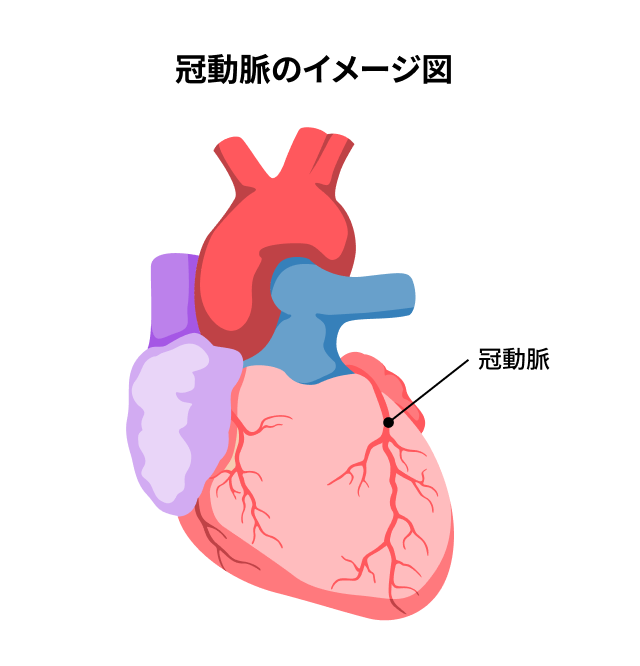 冠動脈のイメージ図