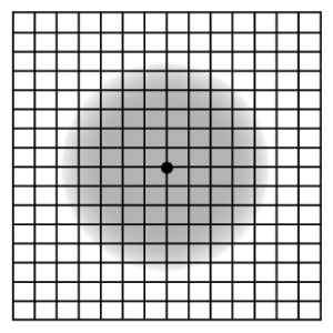 見たい部分が不鮮明に見える場合の画像