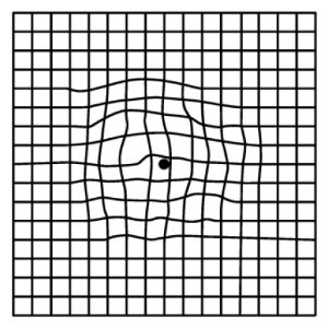 中心がゆがんで見える場合の画像