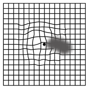 見たい部分が黒くなって見える場合の画像