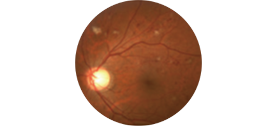 イメージ：眼科受診の大切さ