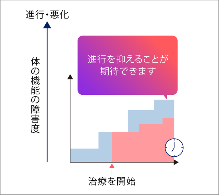 多発性硬化症（MS）の治療を始めた場合