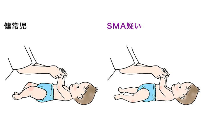 引き起こし反応