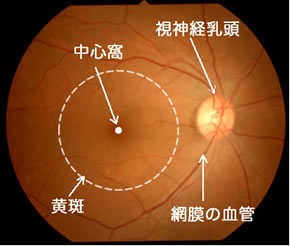 正常な目の眼底写真