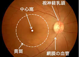 正常な眼の眼底写真