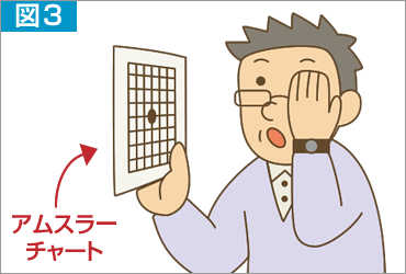 図3 アムスラーチャートを使って片眼ずつ確認することをおすすめします