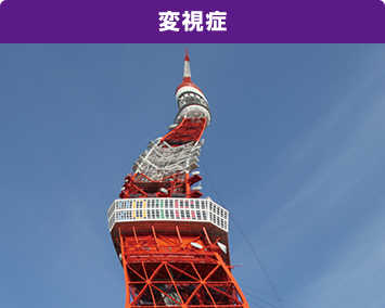 変視症