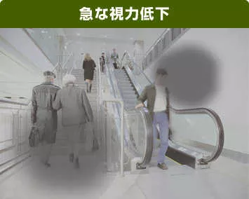 急激な視力低下