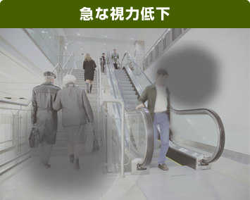 急激な視力低下