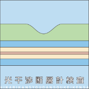 光干渉断層計検査