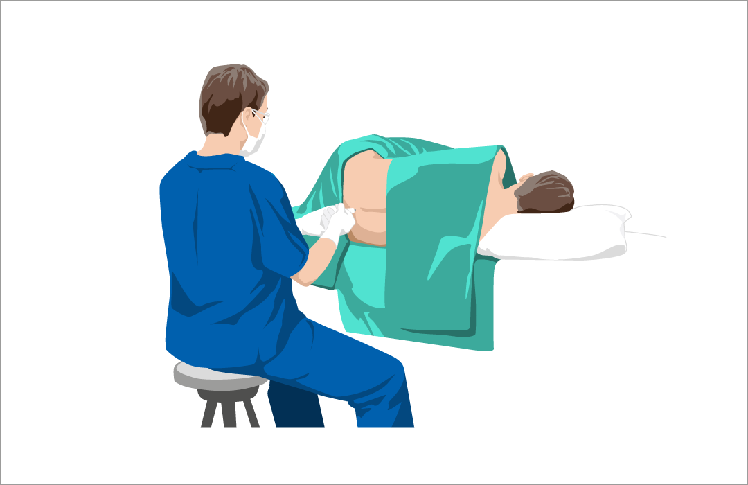 腰に針を刺して髄液を採取する髄液検査