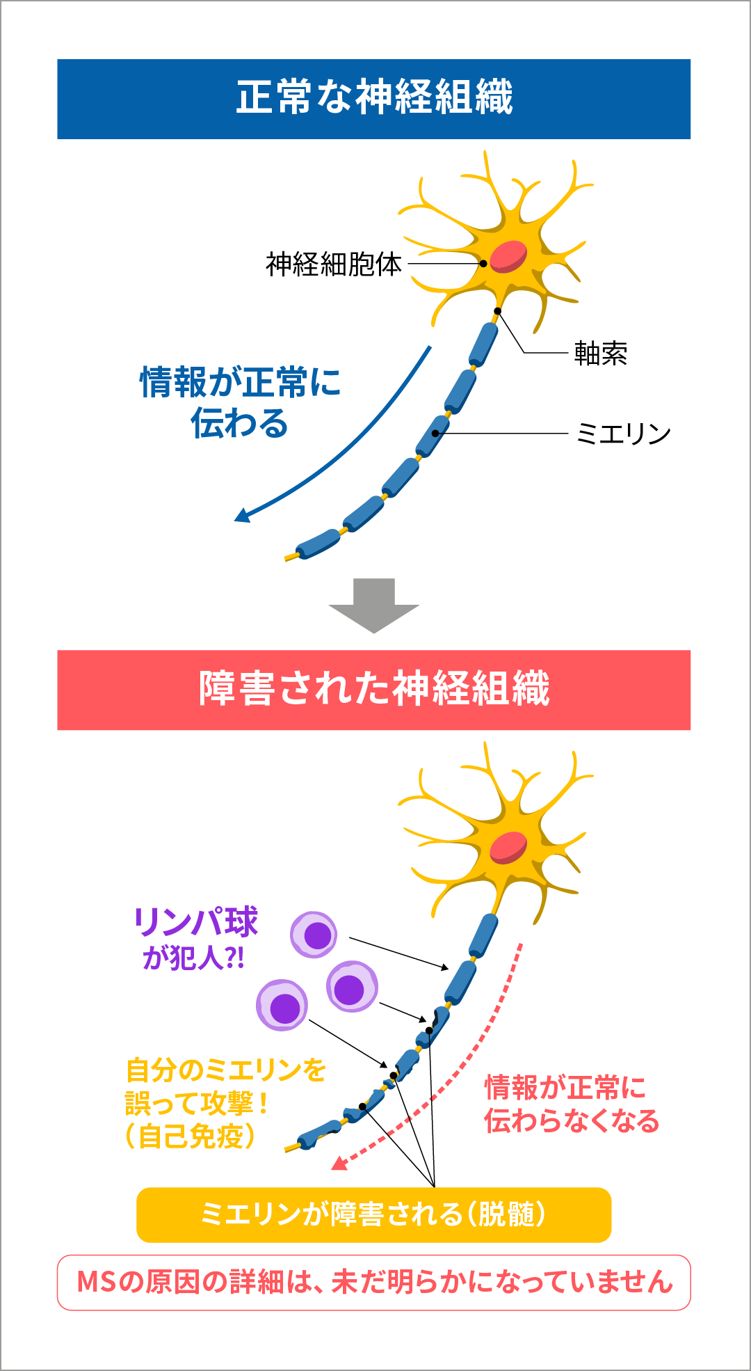 正常な神経組織と障害された神経組織