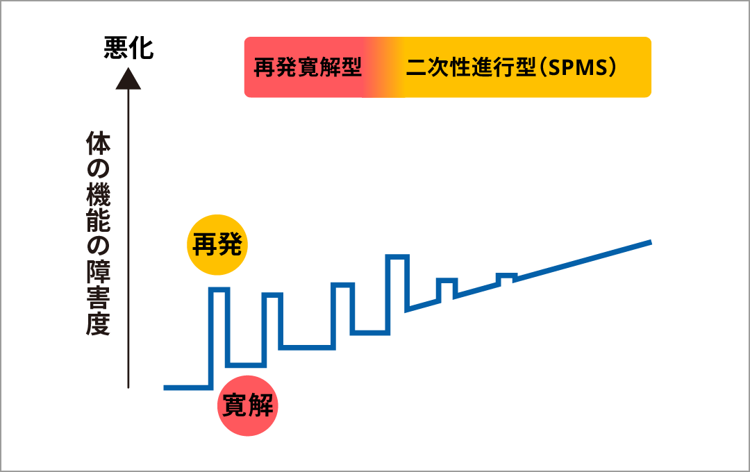 MSは再発寛解型から二次性進行型の経過をたどる